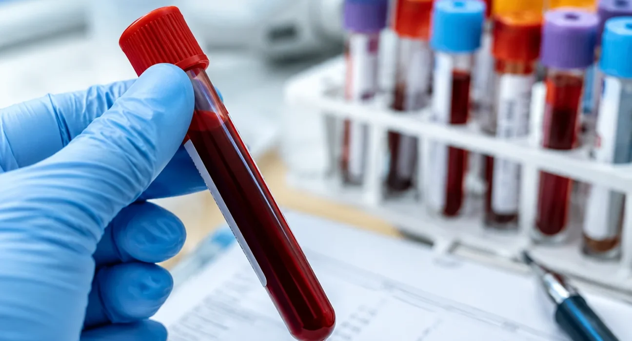 Entzündungswerte im Blut